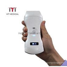 Color Doppler Medical Wireless Ultrasound Machine